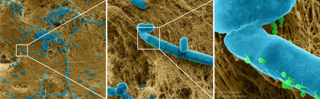 Viral insights: bacteriophages (green) attack E. coli bacteria (blue). Imaged with ZEISS ORION NanoFab.