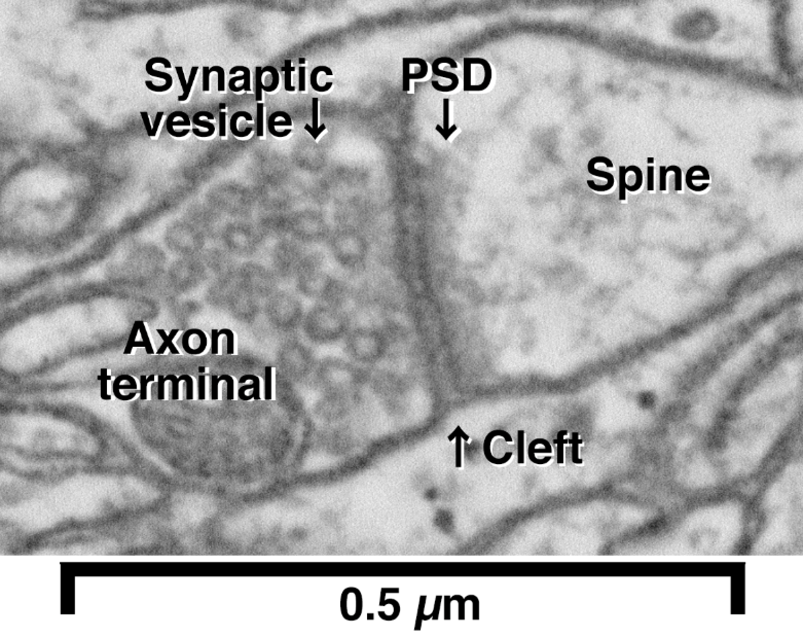 reconstructing-brain-circuits-microscopy