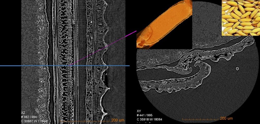 Transverse and longitudinal sections of the 0.7um/voxel resolution scan obtained by magnifying the glume of rice seeds locally.