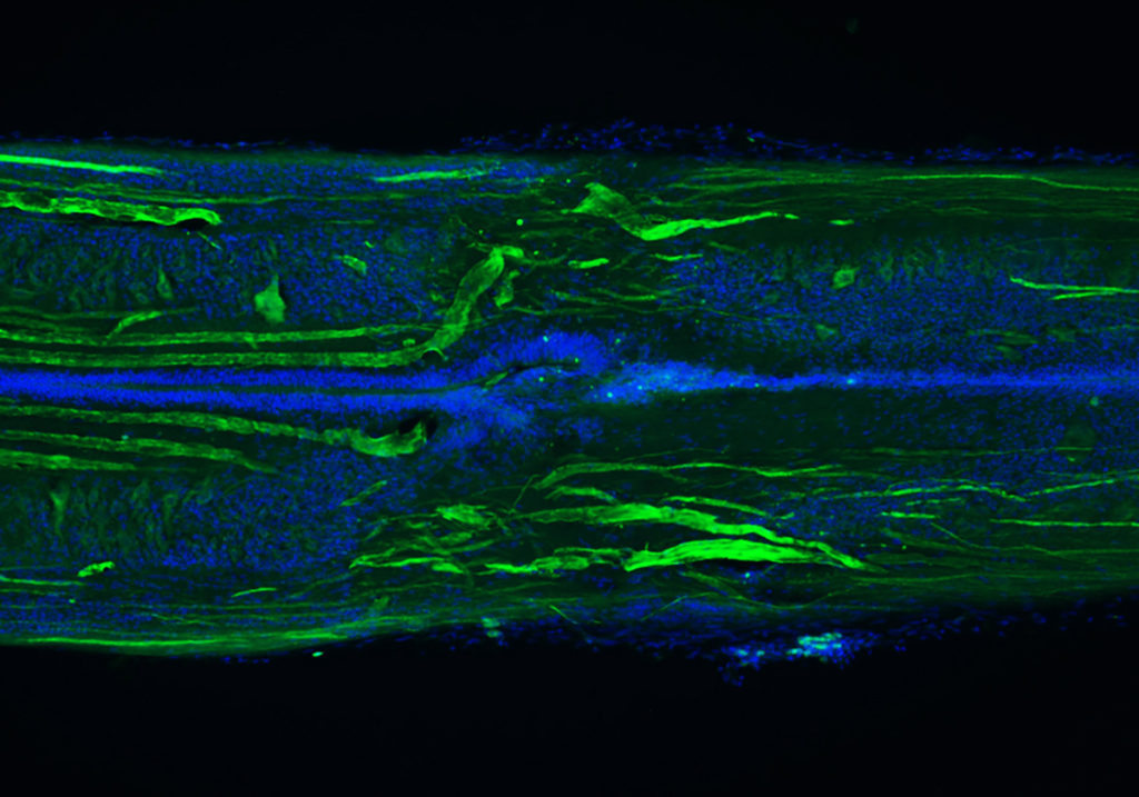 Longitudinal section of a lamprey spinal cord at 11 weeks post-injury, showing many regenerated axons (green) and a repaired central canal (blue tubelike structure). The original lesion site is in the center of the image. Credit: S. Allen and J. Morgan