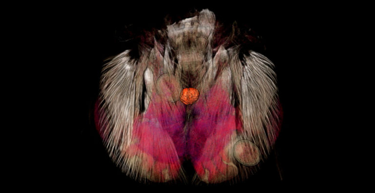 An artificially-coloured image of an ant head with three parasites embedded inside it. Two are outside the brain and one (the orange one in the centre) is inside the brain. This image was created using a ZEISS Versa 520 high resolution micro-CT scanner in the Museum’s Imaging and Analysis Centre. 
Copyright: NHM