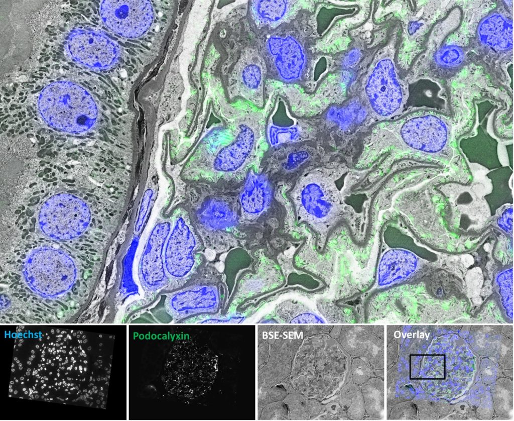 Example of correlative immunofluorescence and electron microscopy imaging with ZEISS Shuttle & Find. The composite image shows very nicely the blue staining of the nuclei and the green fluorescence of podocalyxin over the podocyte foot processes, which can only be fully resolved in the SEM. Light microscopy images were collected with ZEISS Axio Imager 2 and electron microscopy images were collected with ZEISS GeminiSEM 300.
