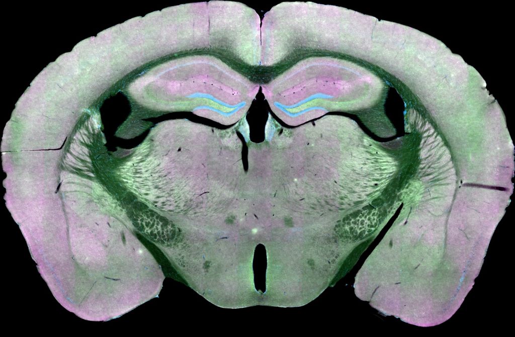 A Better Method For Counting Brain Synapses Microscopy