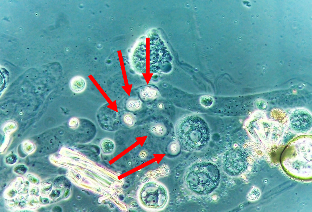 For The Love Of Urinalysis Microscopy 9934