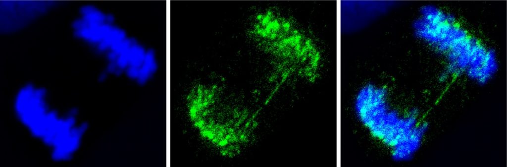 PICH-positive ultra-fine bridges (green) reveal under-replicated DNA in mitosis in U2OS cell. Images were acquired with a ZEISS confocal microscope and processed with ZEISS ZEN software. Image Credit: Dr. Vanesa Gottifredi, Fundación Instituto Leloir (Argentina)