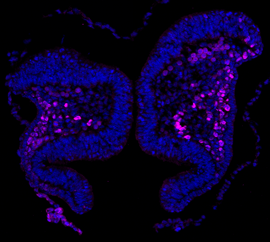 Sox10-positive neural crest cells (magenta) as detected by immunofluorescence staining of a section of cranial neural folds from an E8.0 mouse embryo. Nuclei were stained with DAPI (blue). Imaged with ZEISS Axio Observer 7 fluorescence microscope with structured illumination. Courtesy: Dr. Katherine Fantauzzo, University of Colorado Anschutz Medical Campus (USA)