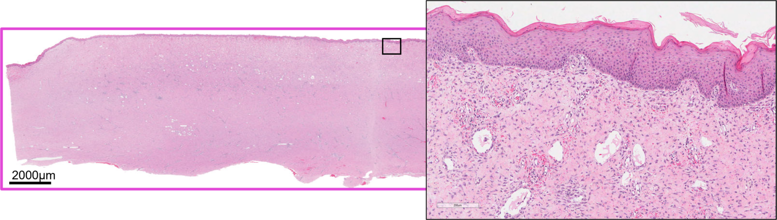 Image 1: Hematoxylin and eosin stain