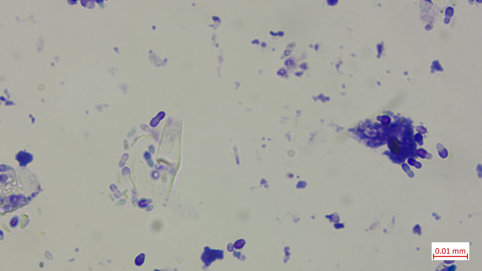 Cytology ear discharge