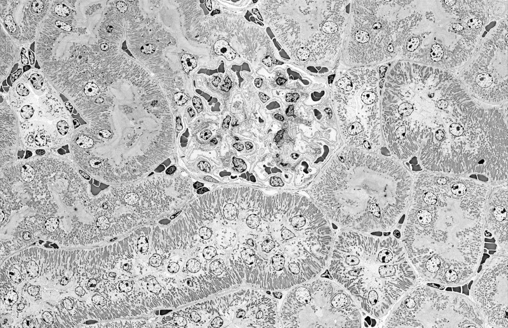 Maus-Nieren-Glomerulus im Zentrum, umgeben von verschiedenen Nierentubuli.